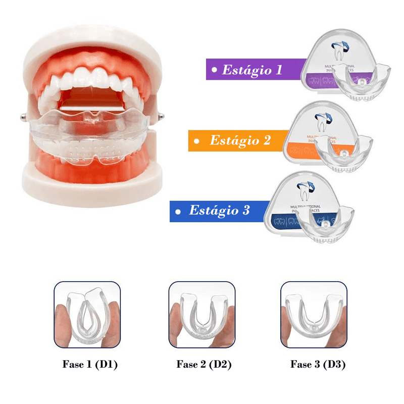 Aparelho dental de silicone - Vitalidade Zenith